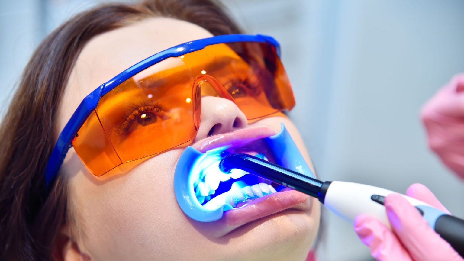 Clareamento Dental: Técnicas, Preços, Cuidados e Respostas para Todas as Suas Dúvidas
