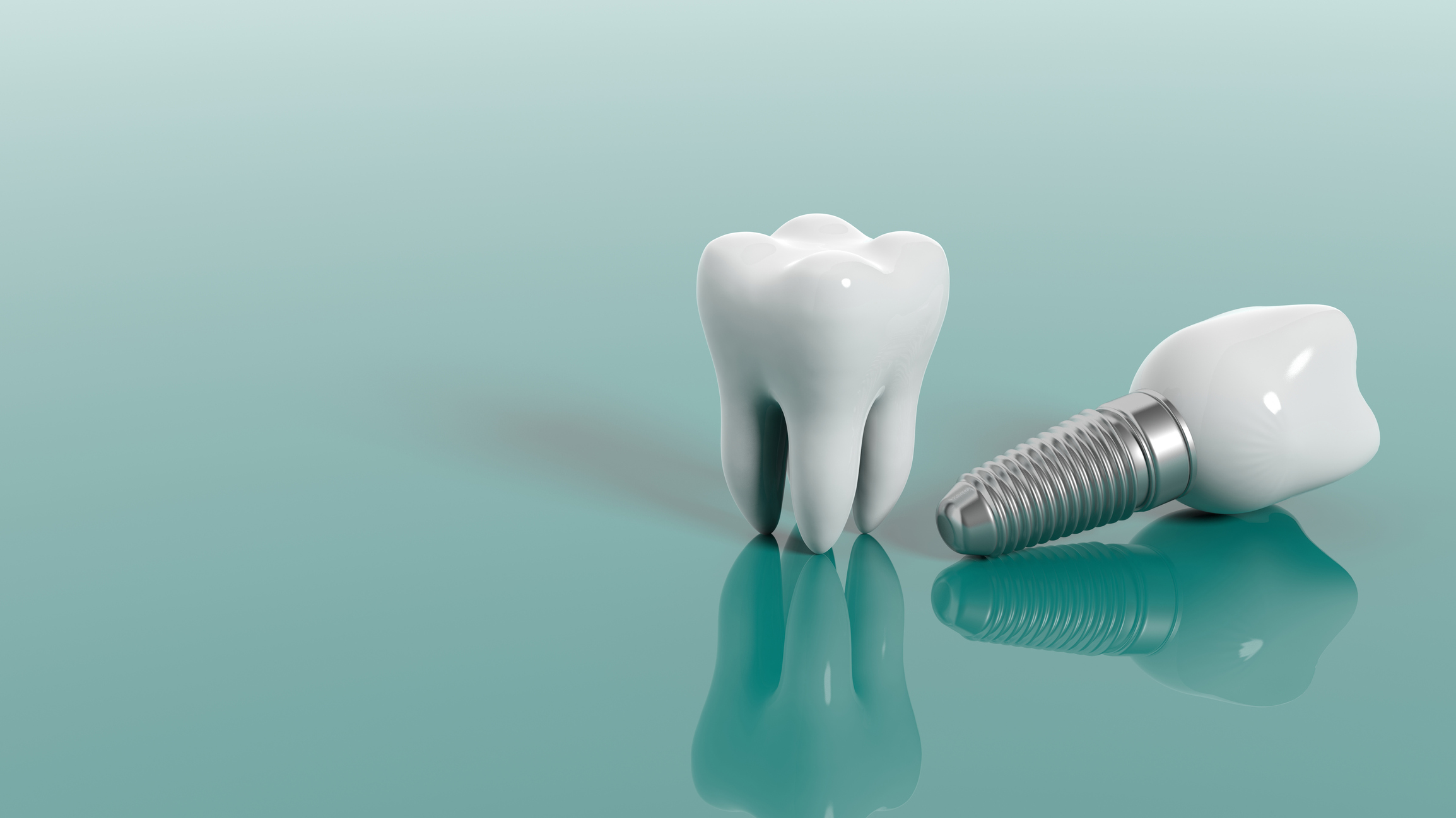 Implantes Dentales: Guía Completa de Tipos, Beneficios, Procedimiento y Costos