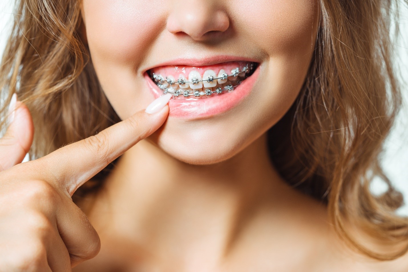 Advanced Orthodontic Care: Braces, Aligners, and Lifestyle Guidance