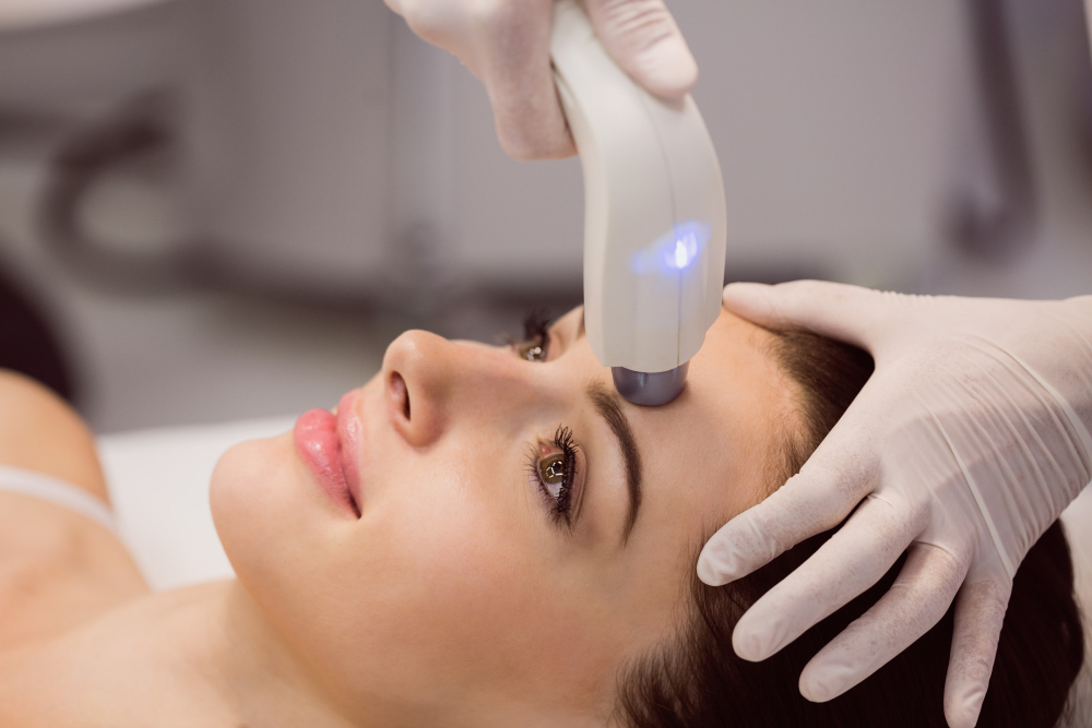 Juvederm Fillers + Laser Tightening: The Complete Non-Surgical Facelift Guide