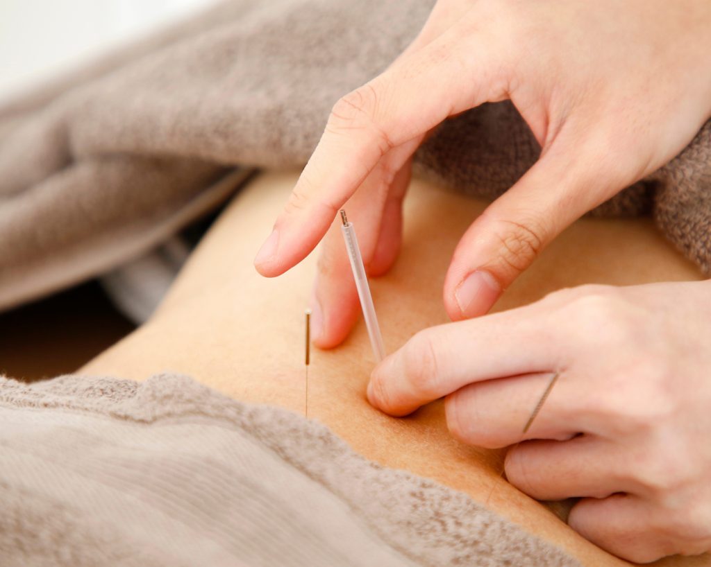 腰椎ヘルニアの痛み・しびれに鍼灸と骨格調整｜自然治癒力を高める保存療法